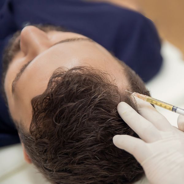 Platelet-Rich Fibrin PRF Woking